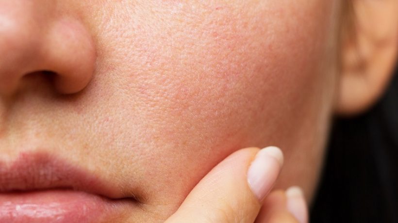 Dry face skin: the causes and treatments to combat it